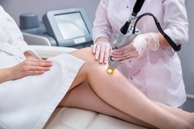 Laser-Hair-Removal-1-800x534